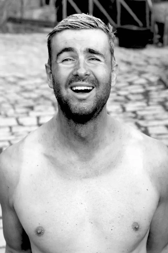 Uomo sorridente con segni sulla pelle lasciati dal sole dopo l'estate